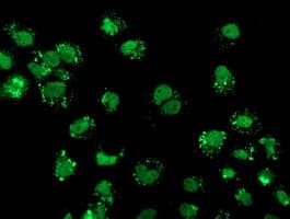 Monoclonal Mouse anti-Human FGFR2 / FGF Receptor 2 Antibody (clone OTI5F7, IF, WB)