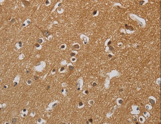 Polyclonal Rabbit anti-Human KIF4A Antibody (IHC)
