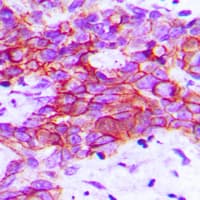 KDR / VEGFR2 / FLK1 Antibody (C-Terminus)