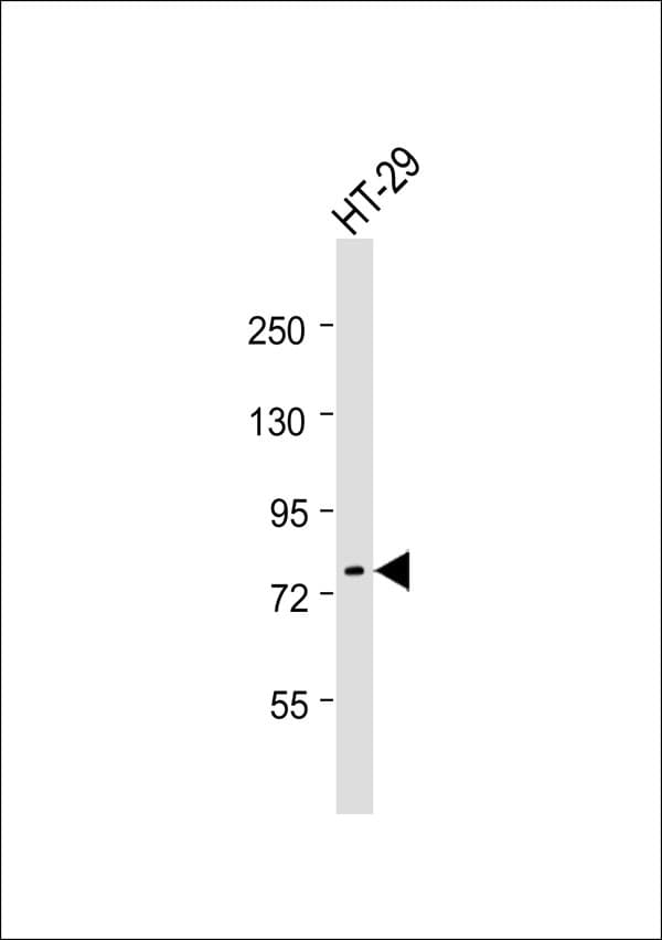 ACSS1 Antibody