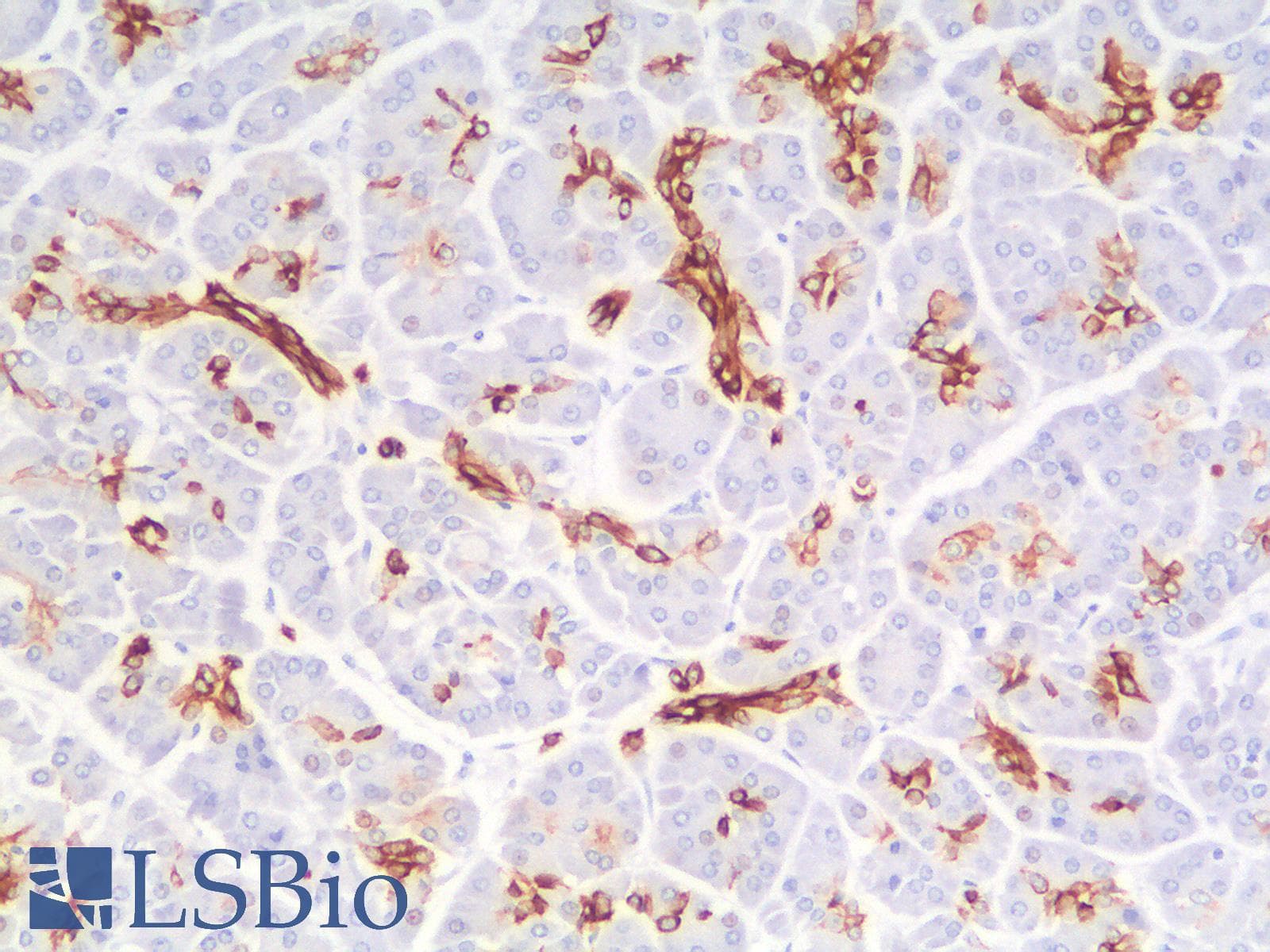 PathPlus™ KRT7 / CK7 / Cytokeratin 7 Antibody (clone rOV-TL12/30)
