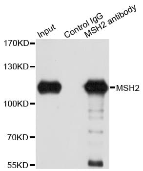 Polyclonal Rabbit anti-Human MSH2 Antibody (IHC, IF, WB)