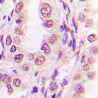 S100P Antibody
