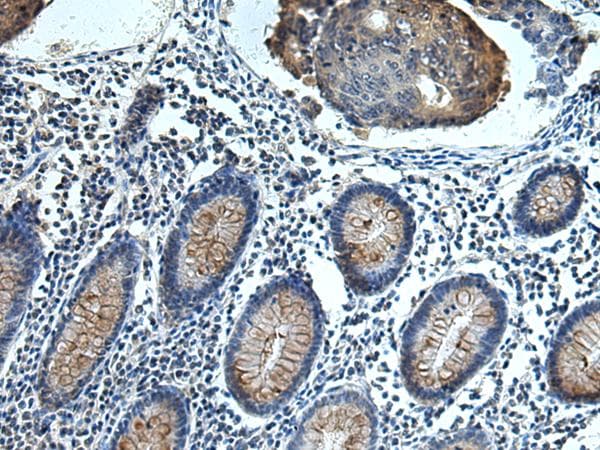 FCRLA Antibody