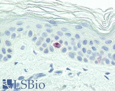 IHC-plus™ Polyclonal Rabbit anti-Human CD207 / Langerin Antibody (IHC, WB)