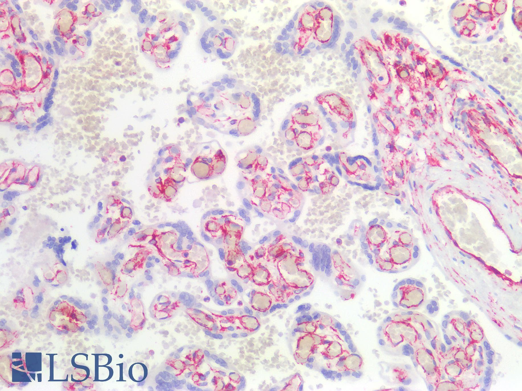 PathPlus™ Vimentin Antibody (clone AT5H8)