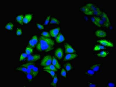 KRT6A / CK6A / Cytokeratin 6A Antibody (aa2-564)