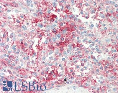 IHC-plus™ CD39 Antibody