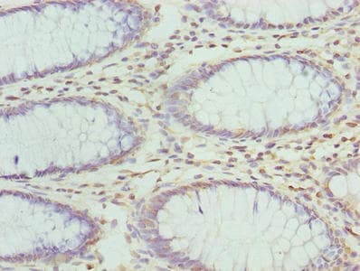 ZNF490 Antibody