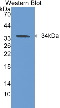 CA-VB / CA5B Antibody (aa34-317, APC, Cy7)