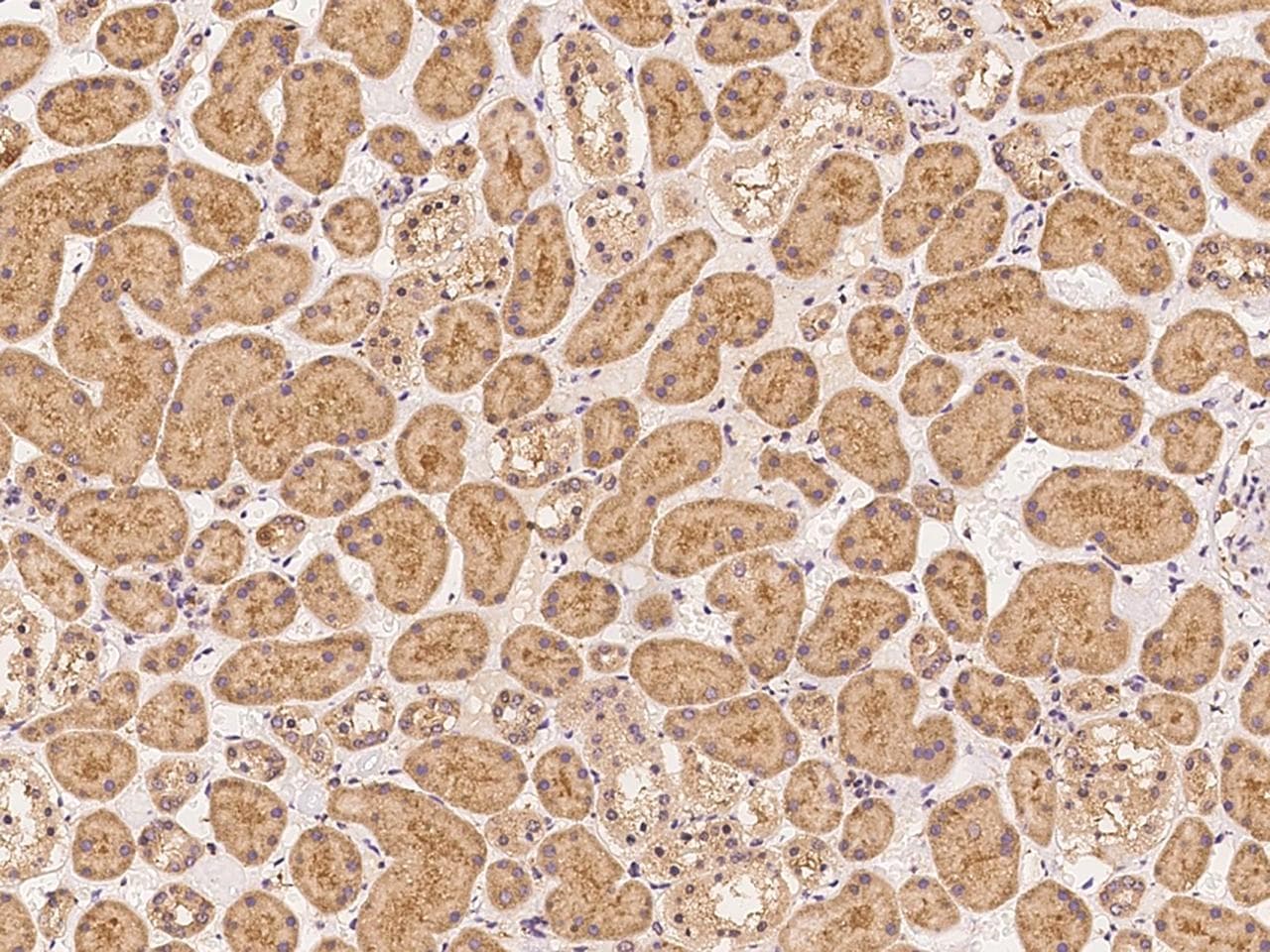 FAM200A Antibody