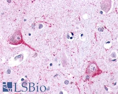 IHC-plus™ ADGRL2 / LPHN2 Antibody (N-Terminus)