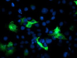 PFKP Antibody (clone OTI2E8, Carrier-free)