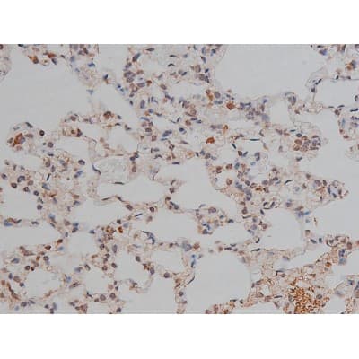 MAPT / Tau Antibody (phospho-Thr231)