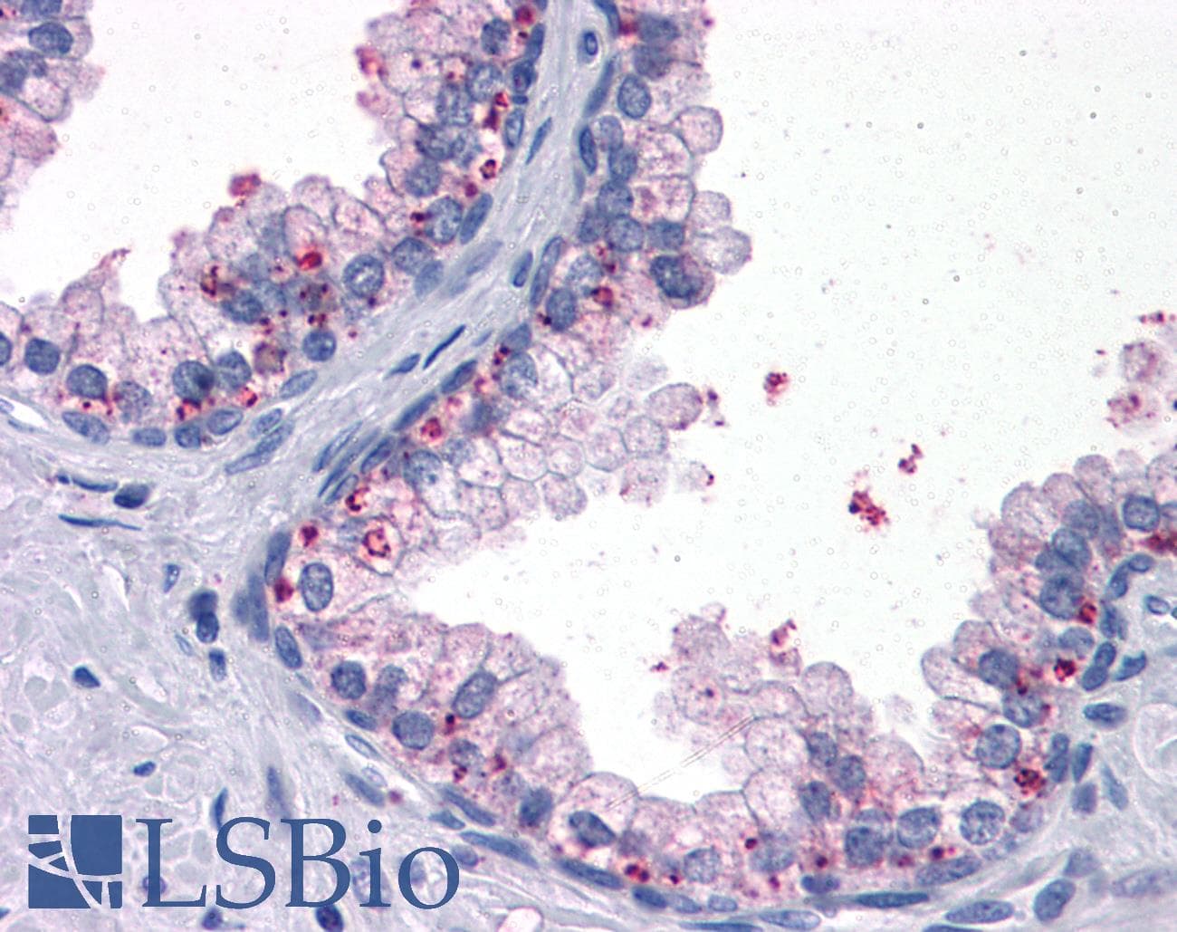 IHC-plus™ SDR9C1 / BDH1 Antibody (clone 1A5)
