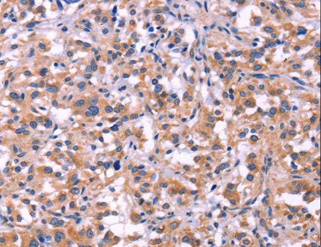 Polyclonal Rabbit anti-Human MMP14 Antibody (IHC)