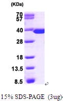 Human TS / Thymidylate Synthase Protein (Recombinant His)