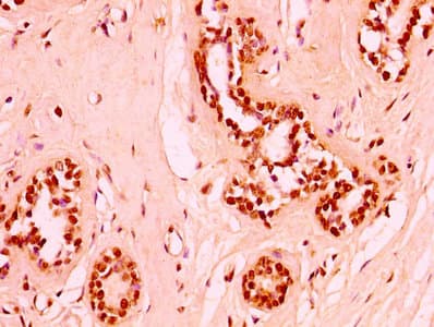 Polyclonal Rabbit anti-Human HIST1H3A Antibody (IHC, WB)