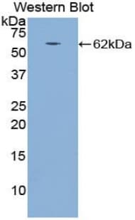 CTSA / Cathepsin A Antibody (aa234-494)