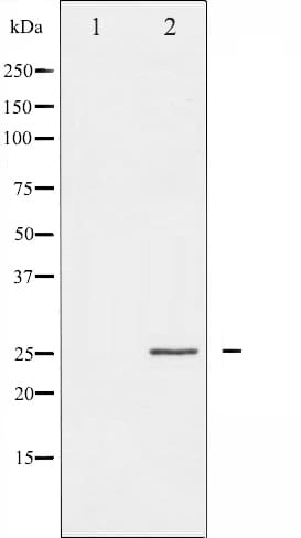 CDKN1A / WAF1 / p21 Antibody