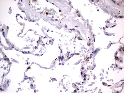 PRX-1 / PRRX1 Antibody (clone OTI1E10)