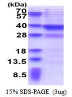 Human MPPED2 Protein (Recombinant His)