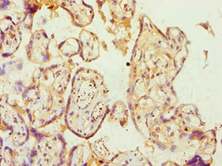 IHC-plus™ AP2A1 / AP2-Alpha Antibody (aa1-260)