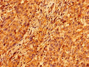 Polyclonal Rabbit anti-Human TMEM142A / ORAI1 Antibody (IHC, WB)