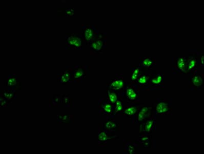 PHF6 Antibody (aa2-312)