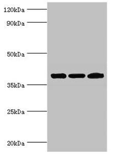 TWF2 / PTK9L Antibody (aa1-369)