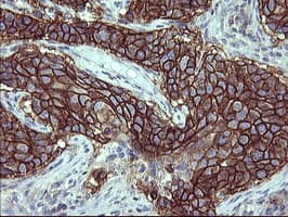 PDGFRB / PDGFR Beta Antibody (clone OTI1E8, Carrier-free)