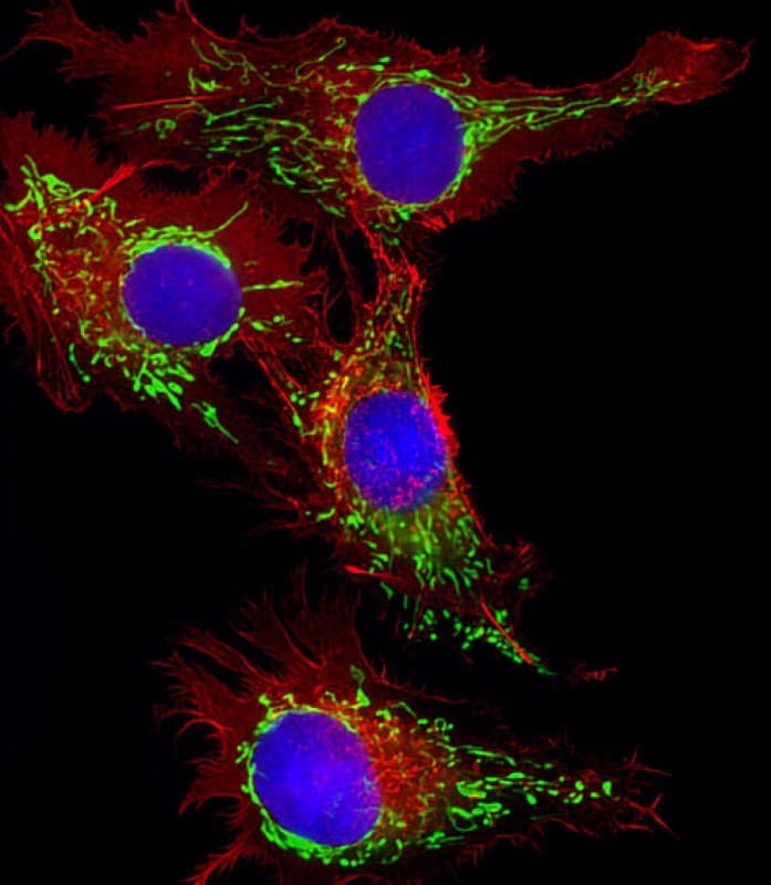 HSPD1 / HSP60 Antibody