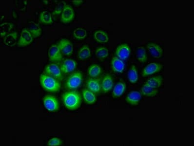 IHC-plus™ CYP17 / CYP17A1 Antibody (aa1-508)