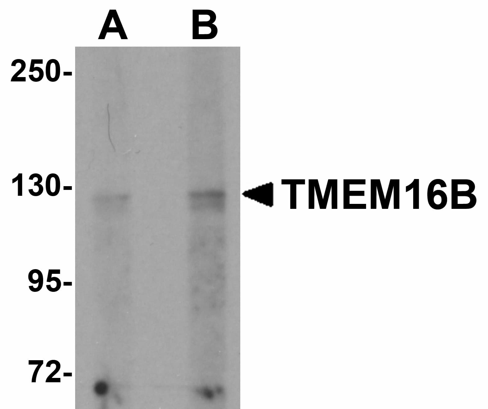 Polyclonal Rabbit anti-Human TMEM16B / ANO2 Antibody (IHC, IF, WB)