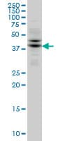 TRIB2 Antibody (clone 1B1)