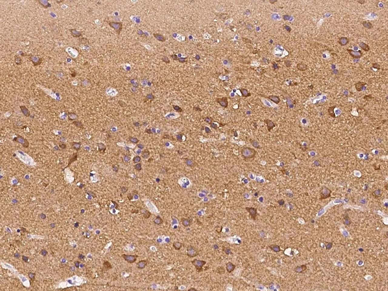 Syndapin I / PACSIN1 Antibody
