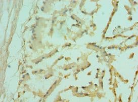Polyclonal Rabbit anti-Human FOXP2 Antibody (aa416-715, IHC)