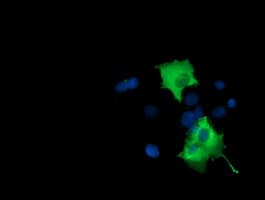 Monoclonal Mouse anti-Human BCAP / PIK3AP1 Antibody (clone OTI7A11, IHC, IF, WB)