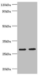 UBC6 / UBE2J2 Antibody (aa1-230)
