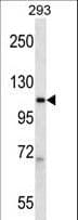 POLR2B / RPB2 Antibody (aa797-826)