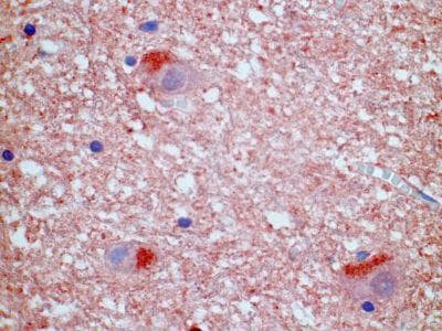 Monoclonal Mouse anti-Human NPBWR1 / GPR7 Antibody (clone 1F9, IHC)