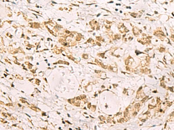 Polyclonal Rabbit anti-Human PDS5A Antibody (IHC)