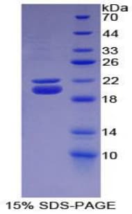Mouse HP / Haptoglobin Protein (Recombinant His)