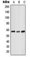 GK / Glycerol Kinase Antibody (C-Terminus)