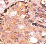 DUSP4 / MKP2 Antibody (aa331-361)