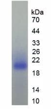 Human ARA55 / HIC-5 Protein (Recombinant)