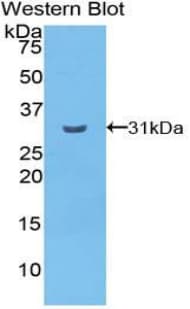 CELSR2 Antibody (aa544-796)