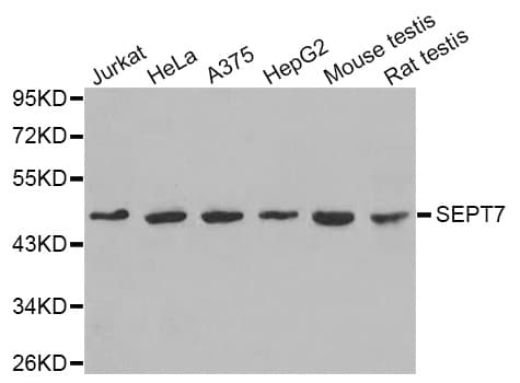 Polyclonal Rabbit anti-Human SEPT7 / Septin 7 Antibody (WB)