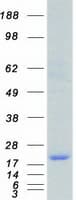 Human CTAG1B / NY-ESO-1 Protein (Recombinant Myc-DDK (Flag))