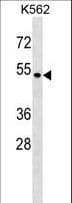 SMAP1 Antibody (aa87-113)